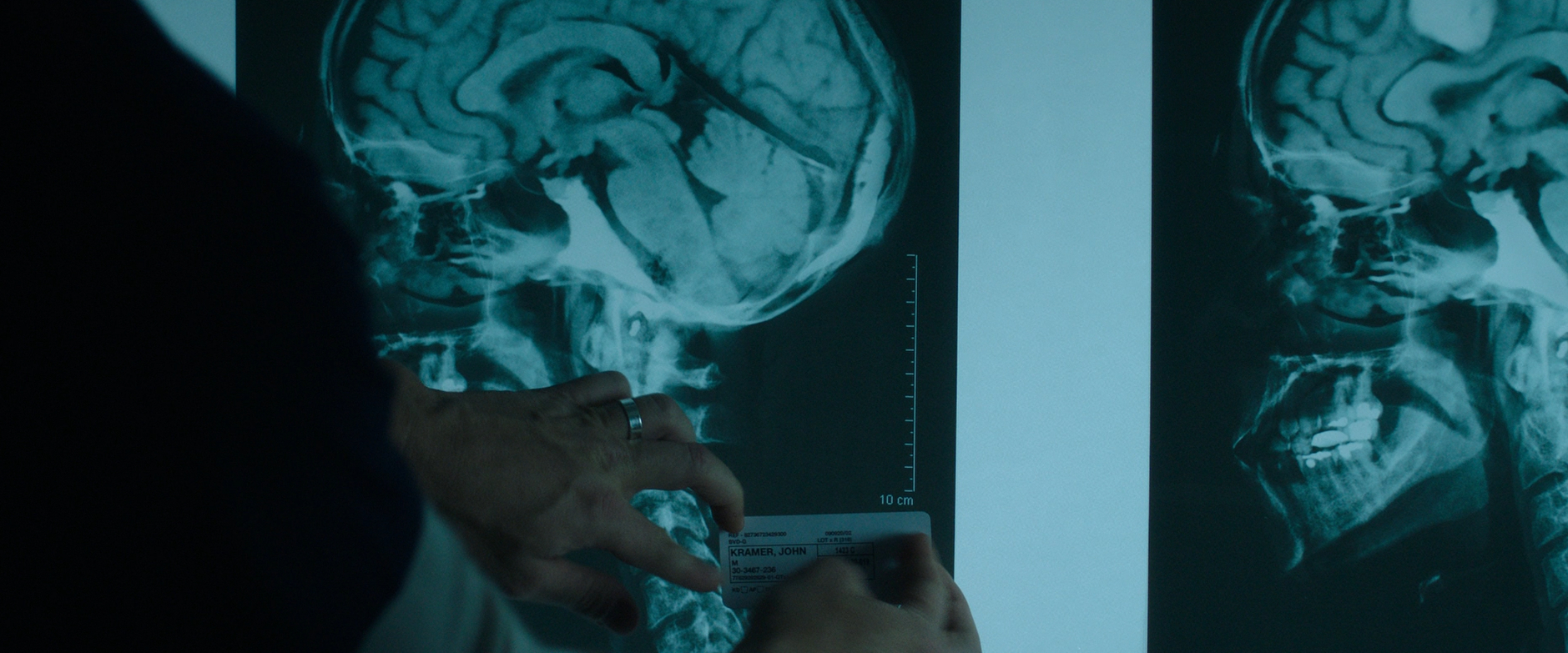 Logan Nelson accidentally mislabels John Kramer's x-ray in Jigsaw (2017).