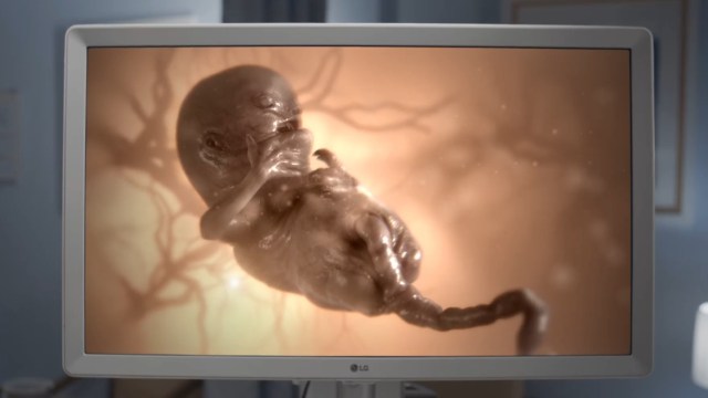 ‘The Fetus’ Starring Lauren LaVera is Nearing Completion, and You Can Help Carry it to Term through Kickstarter